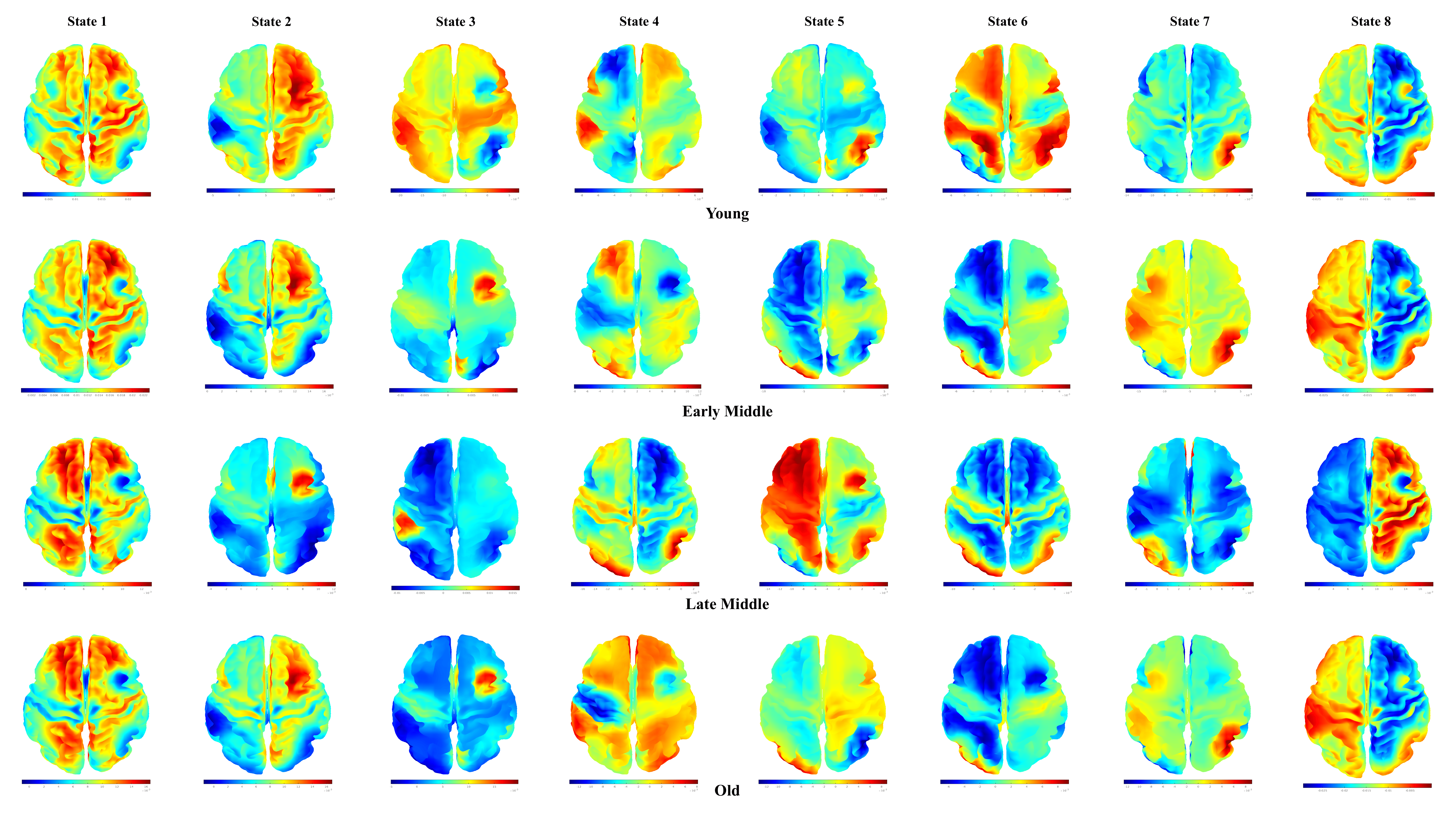 brain-states-image